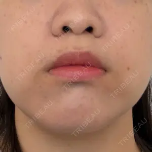 ルラ美容クリニック 池袋院口コミ