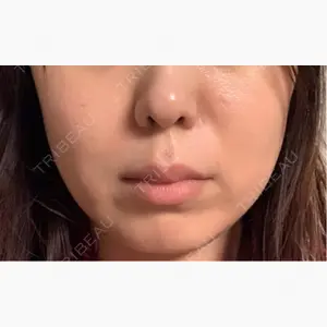 フィラークリニック 新宿院口コミ