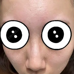 Chloe Cheongdam Clinic （クロエチョンダムクリニック）口コミ