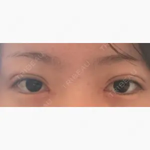 アリエル美容クリニック 大宮院口コミ