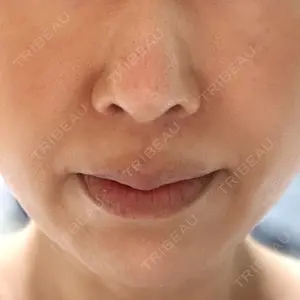 福岡TAクリニック口コミ
