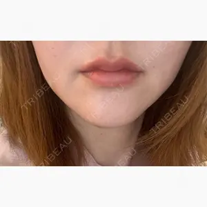 藤・ナチュレ美容クリニック 銀座院口コミ