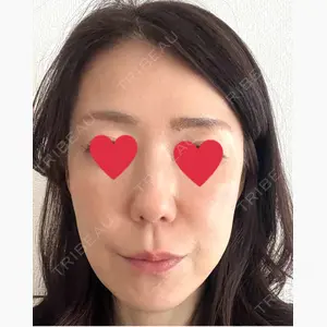 ゆきスキンクリニック 東池袋口コミ