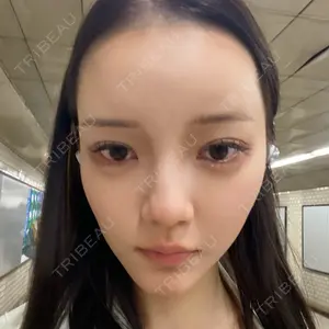 HAAB×DREAM BEAUTY CLINIC 東京本院口コミ
