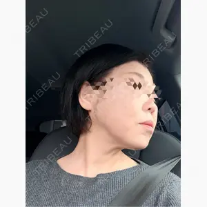 美容皮膚科ティファクリニック 新宿東口口コミ
