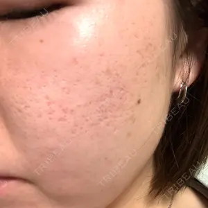 CLEAN BEAUTY CLINIC TokyoAzabu口コミ