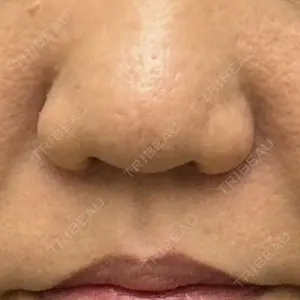 渋谷の森クリニック口コミ