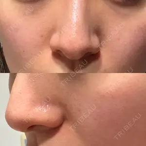 東京美容クリニック 表参道本院口コミ