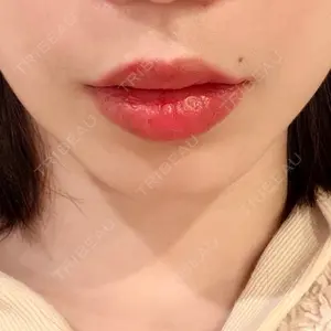 上野美容外科・美容皮膚科口コミ