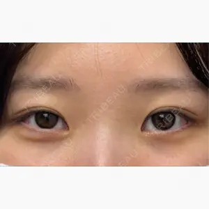 ネビュラクリニック 京都院口コミ