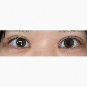 美容皮膚科ティファクリニック 新宿東口口コミ
