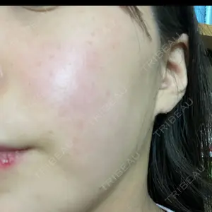 Ledian Clinic六本木口コミ