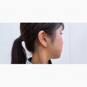 ルラ美容クリニック 新潟院口コミ