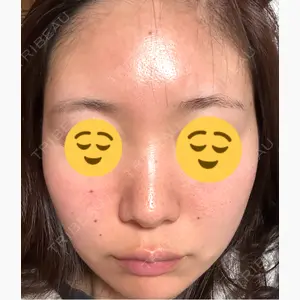 Leap beauty clinic口コミ
