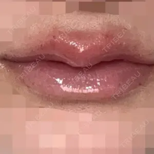 ルラ美容クリニック 大阪本院口コミ