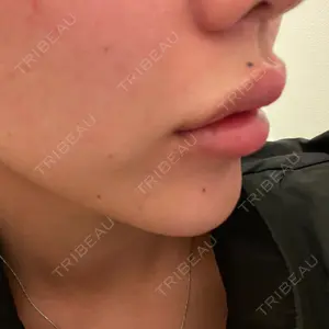 共立美容外科 梅田院口コミ