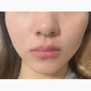 TCB東京中央美容外科 京都駅前院口コミ