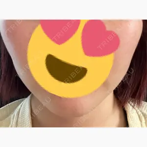 L’or Clinic Omotesando口コミ
