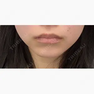 ルラ美容クリニック 大阪本院口コミ