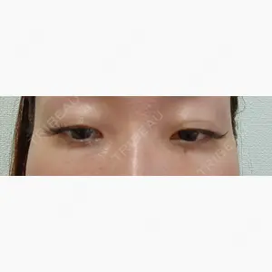 ネビュラクリニック 東京錦糸町院口コミ