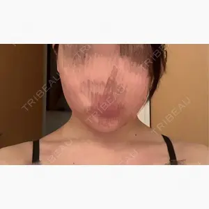 NARU Beauty Clinic 【ナルクリ】 水戸院口コミ