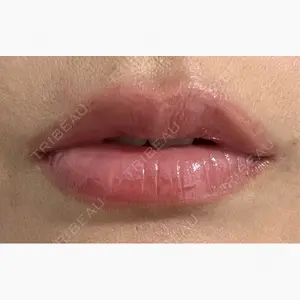 上野美容外科・美容皮膚科口コミ