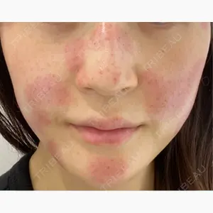 Wi Clinic （ウィ クリニック）心斎橋院口コミ
