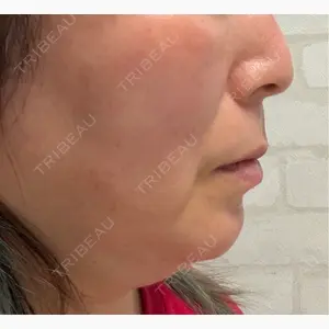 HINATA クリニック口コミ