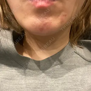 ルラ美容クリニック 広島院口コミ