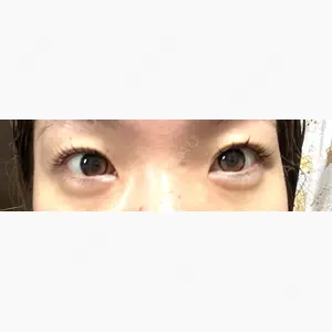吉祥寺アイビークリニック口コミ