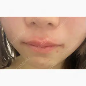YBC横浜美容外科 立川院口コミ