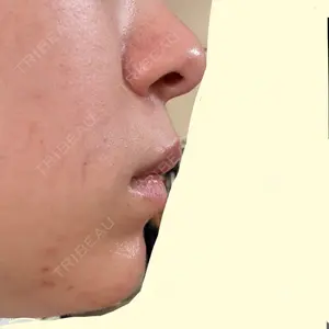 銀座美容外科クリニック 銀座院口コミ