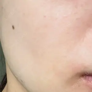 A CLINIC（エークリニック） 仙台院口コミ