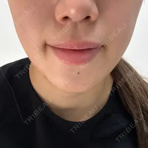 椿クリニック 心斎橋院口コミ