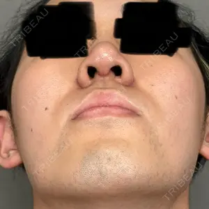 アリエル美容クリニック 大宮院口コミ