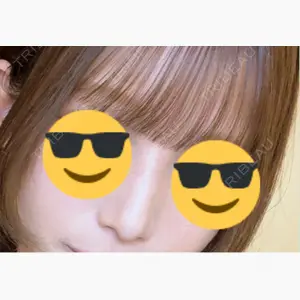 グローバルビューティークリニック 大阪院口コミ
