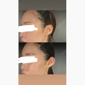 R Beauty CLINIC 銀座院口コミ