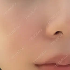 HAAB×DREAM BEAUTY CLINIC 東京本院口コミ