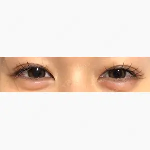 吉祥寺アイビークリニック口コミ