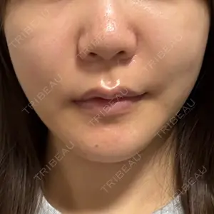 ノエル銀座クリニック口コミ