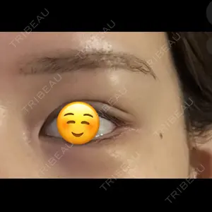 DaysBeautyClinic 銀座院口コミ