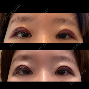 聖心美容クリニック 銀座院口コミ