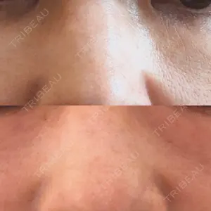 Natural Skin Clinic 自由ヶ丘院口コミ