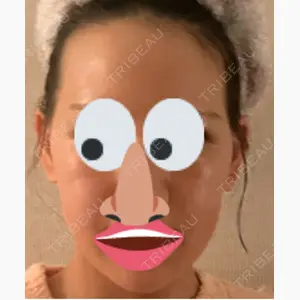 PureMe Skin Clinic（ピュアミースキンクリニック麻布）口コミ