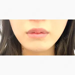 東京シンデレラ美容外科 大宮院口コミ
