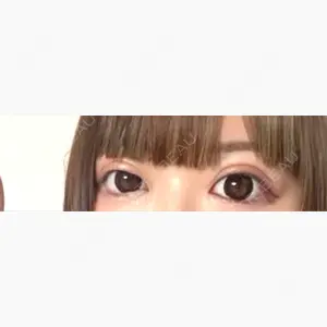 エターナル美容クリニック口コミ