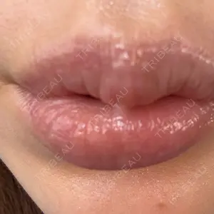 神戸スイミー皮膚科美容外科口コミ