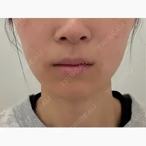 PRO CLINIC プロクリニック 銀座院口コミ