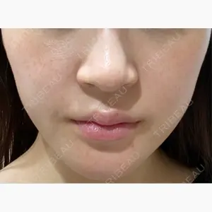 Wi Clinic （ウィ クリニック）心斎橋院口コミ