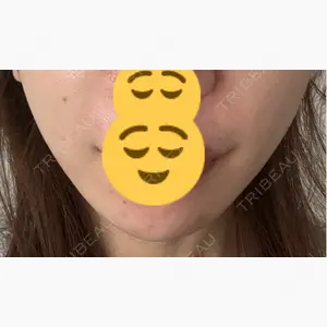 Zetith Beauty Clinic 池袋院口コミ